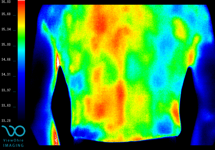 Back Thermography