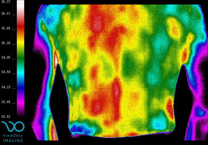 Back Thermography