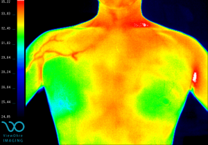 shoulder_pectoral_pain