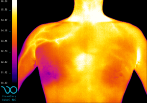 shoulder_pectoral_pain