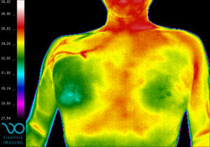 shoulder_pectoral_pain